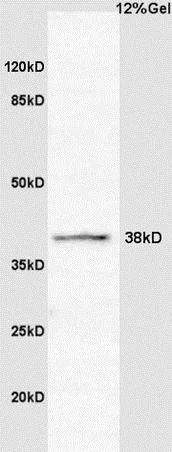Western blot - Anti-CCNG2 antibody (AB203314)