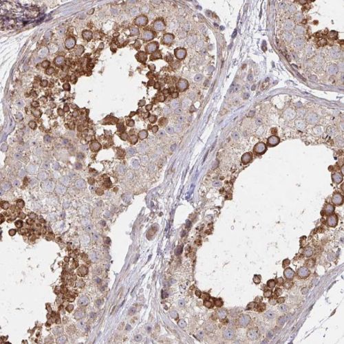 Immunohistochemistry (Formalin/PFA-fixed paraffin-embedded sections) - Anti-CCP1 antibody (AB244512)