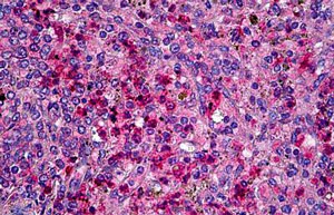Immunohistochemistry (Formalin/PFA-fixed paraffin-embedded sections) - Anti-CCR1 antibody (AB139399)