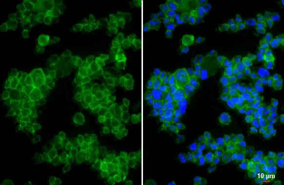 Immunocytochemistry/ Immunofluorescence - Anti-CCR1 antibody [HL2840] - BSA and Azide free (AB325842)
