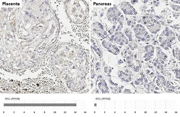 Immunohistochemistry (Formalin/PFA-fixed paraffin-embedded sections) - Anti-CCR1 antibody [HL2840] - BSA and Azide free (AB325842)