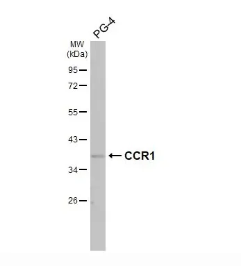 Western blot - Anti-CCR1 antibody [HL2840] - BSA and Azide free (AB325842)
