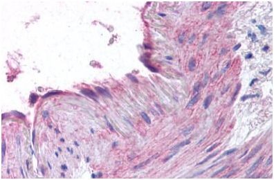 Immunohistochemistry (Formalin/PFA-fixed paraffin-embedded sections) - Anti-CCR1 antibody - N-terminal (AB140756)