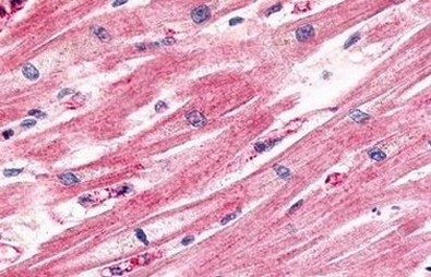 Immunohistochemistry (Formalin/PFA-fixed paraffin-embedded sections) - Anti-CCR11 antibody - Cytoplasmic domain (AB140784), expandable thumbnail