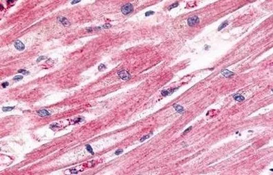 Immunohistochemistry (Formalin/PFA-fixed paraffin-embedded sections) - Anti-CCR11 antibody - Cytoplasmic domain (AB140784)