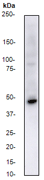 Western blot - Anti-CCR11 antibody [E100] (AB32564), expandable thumbnail