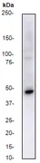 Western blot - Anti-CCR11 antibody [E100] (AB32564)