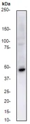 Western blot - Anti-CCR11 antibody [E100] - BSA and Azide free (AB284674)