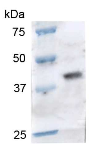 Western blot - Anti-CCR2 antibody (AB223366)