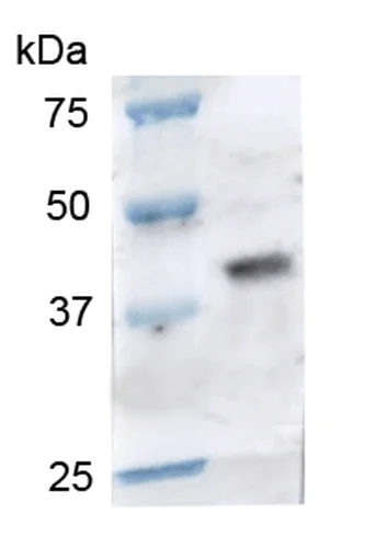 Western blot - Anti-CCR2 antibody (AB223366)