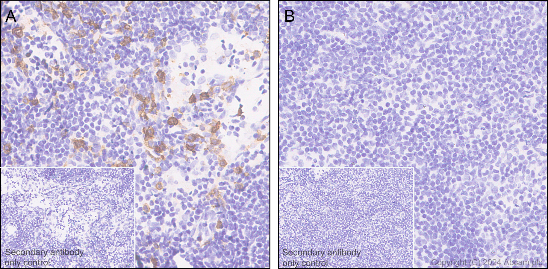 Immunohistochemistry (Formalin/PFA-fixed paraffin-embedded sections) - Anti-CCR2 antibody [EPR20844-15] (AB273050), expandable thumbnail
