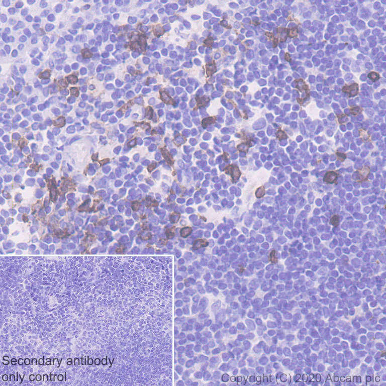 Immunohistochemistry (Formalin/PFA-fixed paraffin-embedded sections) - Anti-CCR2 antibody [EPR20844-15] (AB273050)