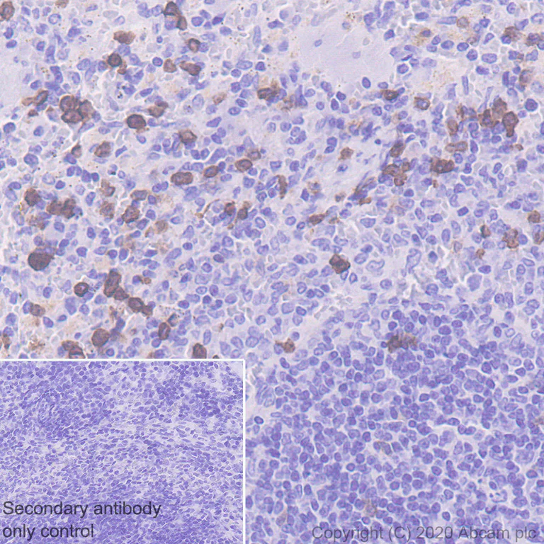 Immunohistochemistry (Formalin/PFA-fixed paraffin-embedded sections) - Anti-CCR2 antibody [EPR20844-15] (AB273050)