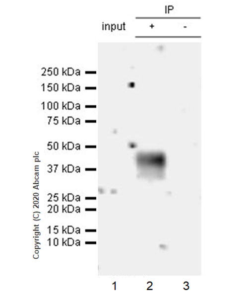 Immunoprecipitation - Anti-CCR2 antibody [EPR20844-15] (AB273050), expandable thumbnail