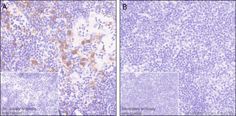 Immunohistochemistry (Formalin/PFA-fixed paraffin-embedded sections) - Anti-CCR2 antibody [EPR20844-15] - BSA and Azide free (AB273061)