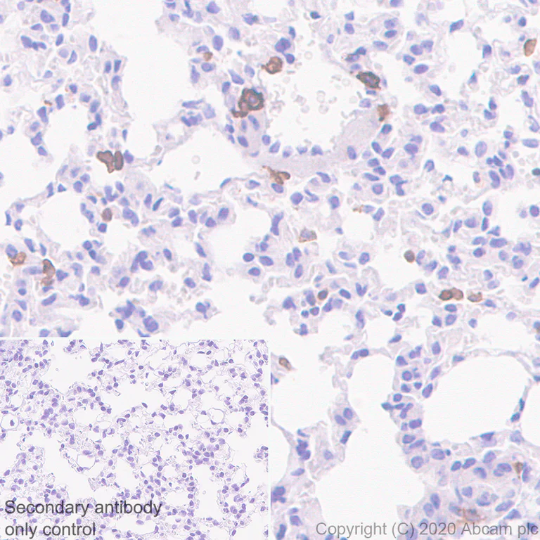 Immunohistochemistry (Formalin/PFA-fixed paraffin-embedded sections) - Anti-CCR2 antibody [EPR20844-15] - BSA and Azide free (AB273061)
