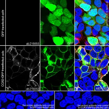 Immunocytochemistry/ Immunofluorescence - Anti-CCR2 antibody [EPR20844] (AB216863)