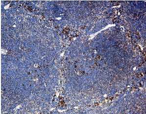Immunohistochemistry (Formalin/PFA-fixed paraffin-embedded sections) - Anti-CCR3 antibody (AB25789)