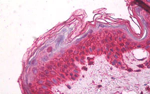 Immunohistochemistry (Formalin/PFA-fixed paraffin-embedded sections) - Anti-CCR3 antibody - N-terminal (AB189346)