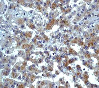 Immunohistochemistry (Formalin/PFA-fixed paraffin-embedded sections) - Anti-CCR3 antibody [Y31] - BSA and Azide free (AB271832)