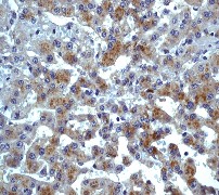 Immunohistochemistry (Formalin/PFA-fixed paraffin-embedded sections) - Anti-CCR3 antibody [Y31] - Low endotoxin, Azide free (AB228341), expandable thumbnail