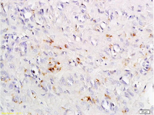 Immunohistochemistry (Formalin/PFA-fixed paraffin-embedded sections) - Anti-CCR4 antibody (AB216560)
