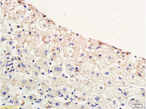 Immunohistochemistry (Formalin/PFA-fixed paraffin-embedded sections) - Anti-CCR4 antibody (AB216560)