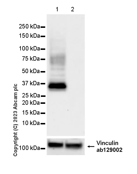 Western blot - Anti-CCR4 antibody [EPR26522-156] - BSA and Azide free (AB315447)