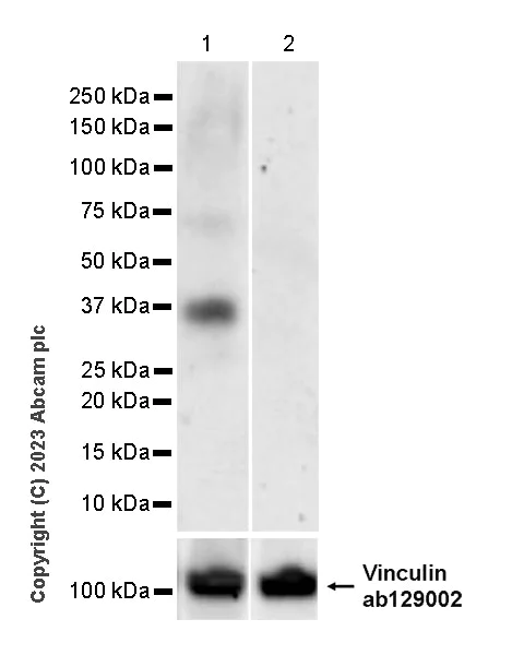 Western blot - Anti-CCR4 antibody [EPR26522-156] - BSA and Azide free (AB315447)