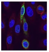 Immunocytochemistry/ Immunofluorescence - Anti-CCR4 antibody [KH-4F5] (AB59550)
