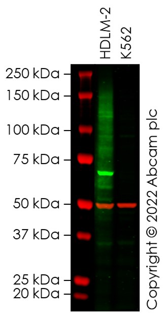 Western blot - Anti-CCR4 antibody [KW-0761 (Mogamulizumab)] - Rabbit IgG (Chimeric) (AB275980), expandable thumbnail