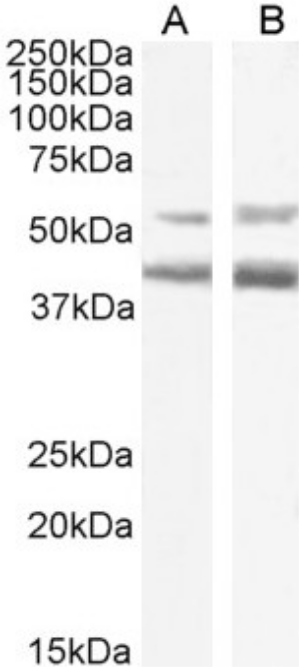 Western blot - Anti-CCR4 antibody [KW-0761 (Mogamulizumab)] - Rabbit IgG (Chimeric) (AB275980), expandable thumbnail