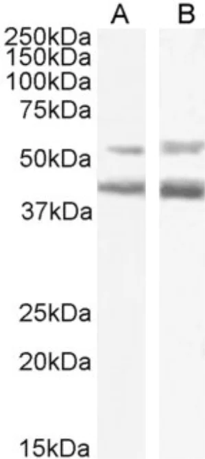 Western blot - Anti-CCR4 antibody [KW-0761 (Mogamulizumab)] - Rabbit IgG (Chimeric) (AB275980)