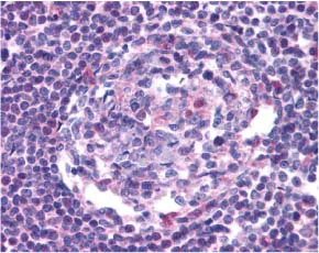Immunohistochemistry (Formalin/PFA-fixed paraffin-embedded sections) - Anti-CCR5 antibody (AB7346)