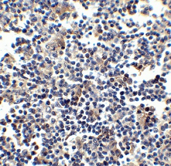 Immunohistochemistry (Formalin/PFA-fixed paraffin-embedded sections) - Anti-CCR5 antibody (AB7346)