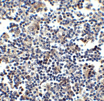 Immunohistochemistry (Formalin/PFA-fixed paraffin-embedded sections) - Anti-CCR5 antibody (AB7346)