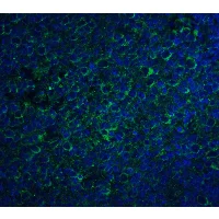 Immunohistochemistry (Formalin/PFA-fixed paraffin-embedded sections) - Anti-CCR5 antibody (AB7346)