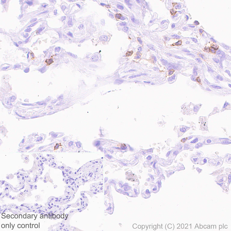 Immunohistochemistry (Formalin/PFA-fixed paraffin-embedded sections) - Anti-CCR5 antibody [EPR24589-95] (AB287959)