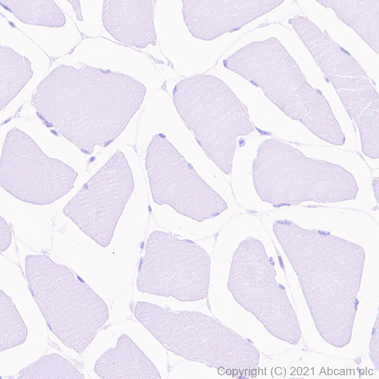 Immunohistochemistry (Formalin/PFA-fixed paraffin-embedded sections) - Anti-CCR5 antibody [EPR24589-95] (AB287959)