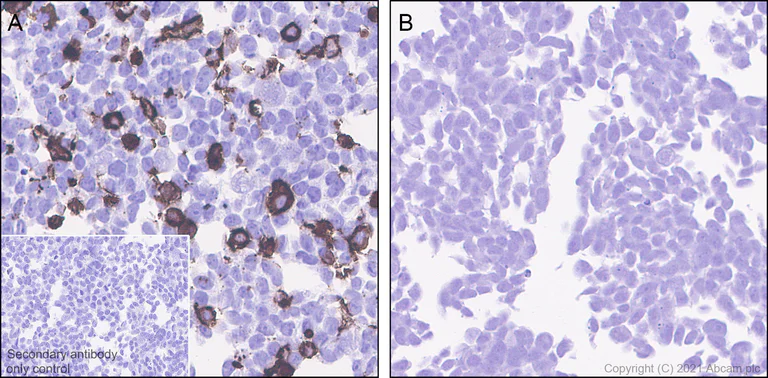 Immunohistochemistry (Formalin/PFA-fixed paraffin-embedded sections) - Anti-CCR5 antibody [EPR24589-95] - BSA and Azide free (AB287963)