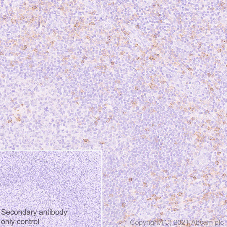 Immunohistochemistry (Formalin/PFA-fixed paraffin-embedded sections) - Anti-CCR5 antibody [EPR24589-95] - BSA and Azide free (AB287963)