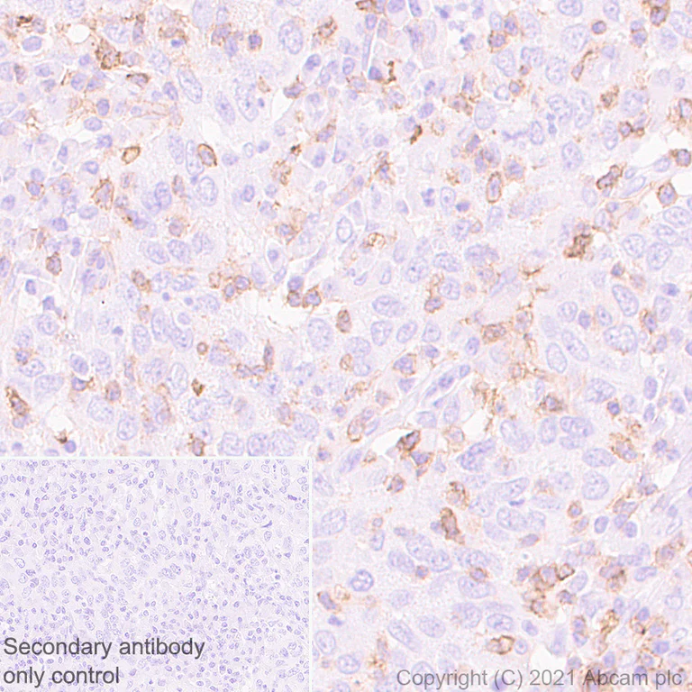 Immunohistochemistry (Formalin/PFA-fixed paraffin-embedded sections) - Anti-CCR5 antibody [EPR24589-95] - BSA and Azide free (AB287963)