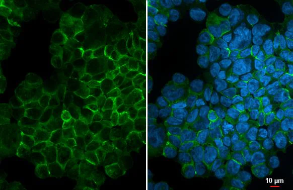 Immunocytochemistry/ Immunofluorescence - Anti-CCR5 antibody [HL3650] - BSA and Azide free (AB325843)