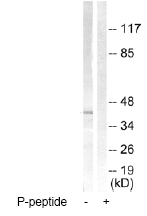 Western blot - Anti-CCR5 (phospho S336) antibody (AB63441)