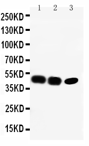 Western blot - Anti-CCR6 antibody (AB78429), expandable thumbnail