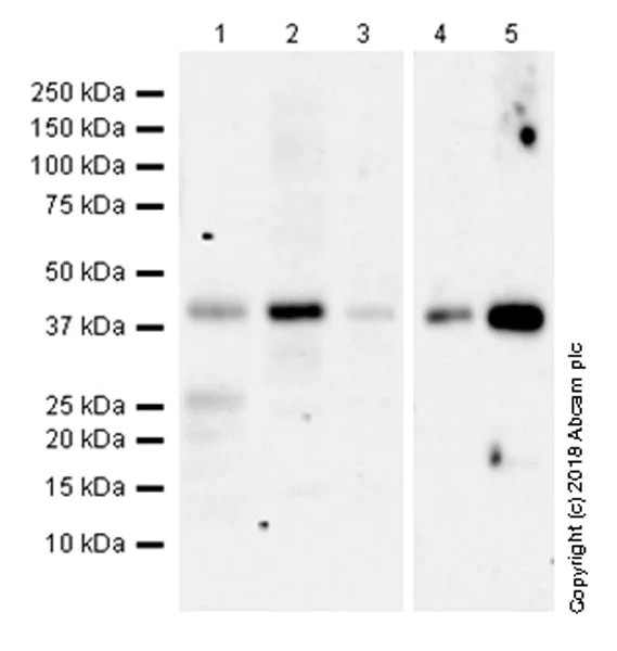 Western blot - Anti-CCR6 antibody [EPR22259] (AB227036)