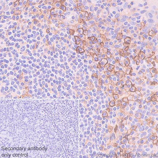 Immunohistochemistry (Formalin/PFA-fixed paraffin-embedded sections) - Anti-CCR6 antibody [EPR22259] - BSA and Azide free (AB243852)