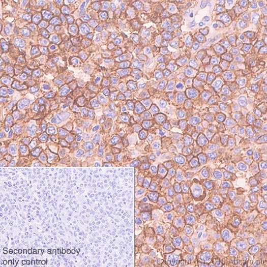 Immunohistochemistry (Formalin/PFA-fixed paraffin-embedded sections) - Anti-CCR6 antibody [EPR22259] - BSA and Azide free (AB243852), expandable thumbnail