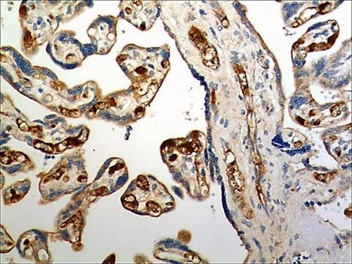 Immunohistochemistry (Formalin/PFA-fixed paraffin-embedded sections) - Anti-CCR6 antibody [MM0066-3L1] (AB93086)