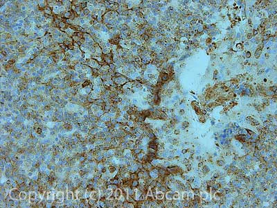 Immunohistochemistry paraffin embedded sections - Anti-CCR6 antibody [MM0066-3L1] (AB93086)
